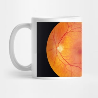 Healthy retina (P424/0175) Mug